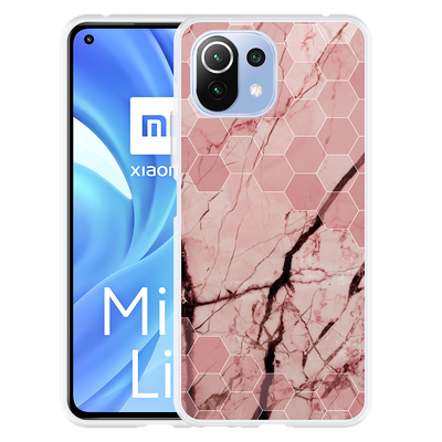 Cazy Hoesje geschikt voor Xiaomi Mi 11 Lite - Pink Marble